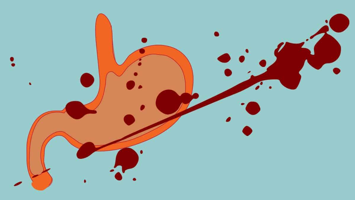 Obat Buang Air Besar Berdarah